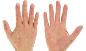 Tất tần tật về cách chăm sóc da tay bị khô