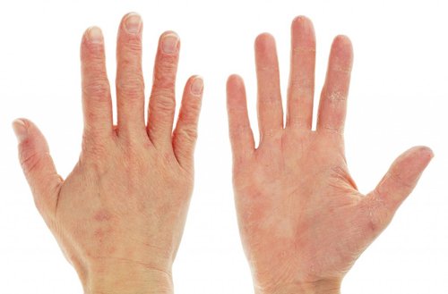 Tất tần tật về cách chăm sóc da tay bị khô